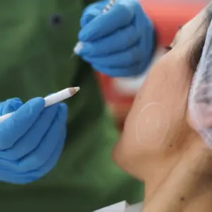 Doctor marking patient's jawline for cosmetic procedure
