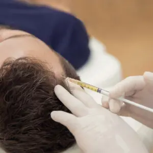 Man receiving scalp injection for hair restoration