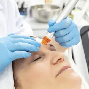 Woman receiving cosmetic facial laser treatment